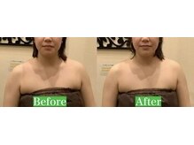 アジール 長岡リバーサイド千秋店(agir)/before/after画像