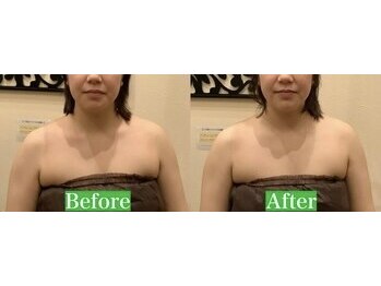 アジール 長岡リバーサイド千秋店(agir)/before/after画像
