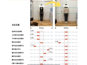 しのまる整体/<グループ院事例>全身の歪み改善