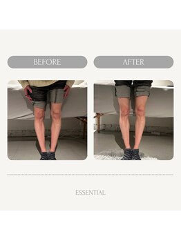 エッセンシャル 南海難波店(ESSENTIAL)/O脚改善¥2,500/なんば