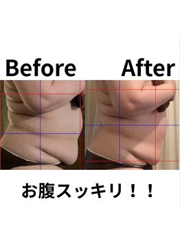 ポノ(pono)/内臓ケア（貼るだけWINBACK）