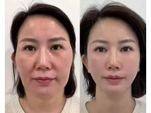 楽だの雰囲気（「徒手骨雕」新中式三維立体徒手骨相造型術♪骨格／筋膜／肌質◎）