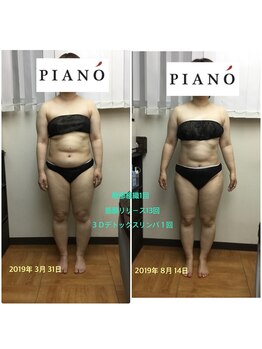 ピアーノ(PIANO)/筋膜リリース