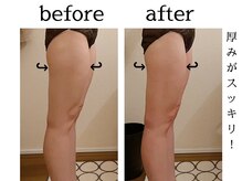 サロン ド ユキフラン(Salon de Yukifranc)/施術部位→下半身