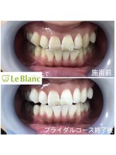 ルブラン 奈良店(Le Blanc)/丁寧なブラッシング