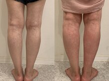 酵素TOKYO 千歳船橋店/左）ビフォー　右）アフター