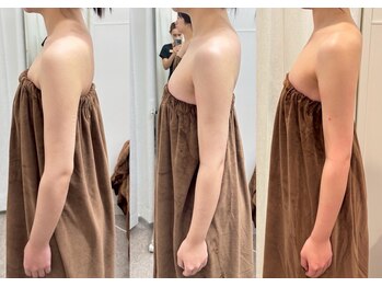 ロココ 豊田店(Rococo)/ビフォーアフター