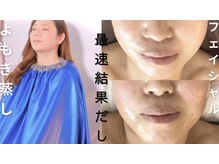 ビューティーツリー(Beauty Tree)