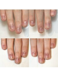 男性も自爪育成でご来店