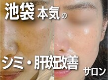 オリエンタルビューティー(ORIENTAL BEAUTY)