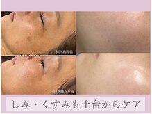 MMKの雰囲気（川口N.o1ハーブピーリング剥離あり☆フェイシャルお悩み土台改善）