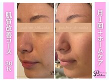 プルクレ 常磐町店(Pulchre)/毛穴をきれいにしたい♪