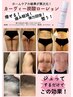 ジュッとするだけ！フォトギャラリーのB&A【カーヴィー炭酸】効果体験　¥1100