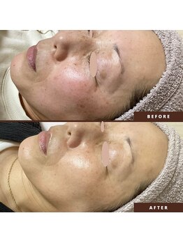 ネリネ(Nerine)/自分の肌が好きになる