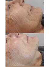 ティーボックスボーテ(TBOX beaute)/