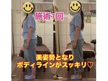 マナリノ(Mana Lino)/同じ服でも施術前と後で全然違う