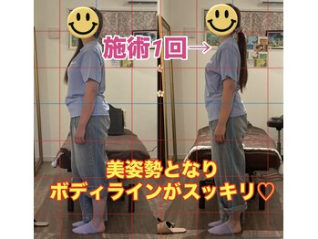 マナリノ(Mana Lino)/同じ服でも施術前と後で全然違う