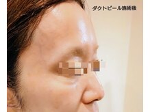 アンジュ(Anju)の雰囲気（しわがなくなり、つるんとした艶肌に変化して頂けます）