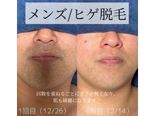 カナウ(KANAU)の雰囲気（男性のvioやヒゲ、濃いムダ毛の脱毛が得意◎男性来店率8割以上！）