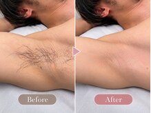 ラディス(Ladis)の雰囲気（【メンズ脱毛大歓迎◎】wax&光脱毛で清潔感あるお肌に）