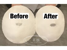 美極 トータルビューティー(美極 TOTAL BEAUTY)/恵比寿/小顔コルギ/エステ/