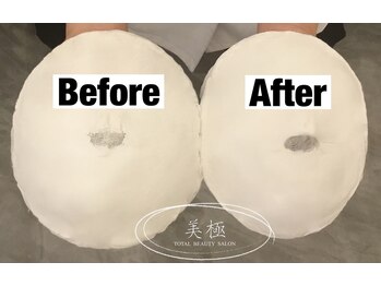 美極 トータルビューティー(美極 TOTAL BEAUTY)/恵比寿/小顔コルギ/エステ/