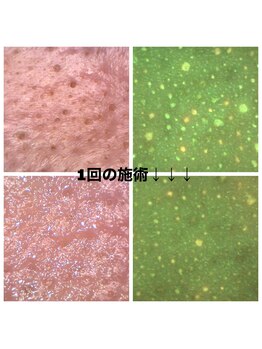 ベベ クロス ディディア 北見店(Bebe×DiDiA)/１度でも詰まりを綺麗に除去＊