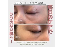 お家でも使えるハーブピーリングホームケア商品もご用意★