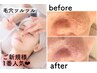 【皮脂や黒ずみ！毛穴掃除】しっかりお手入れ♪毛穴すっきりタラソコース60分