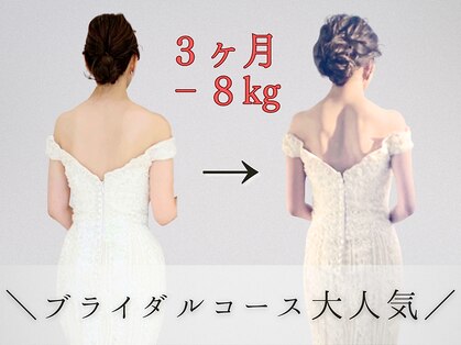 ビジュクイーン(BIJOU QUEEN)の写真