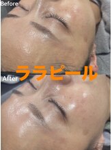 salon結(yui)/ララピール　ビフォーアフター