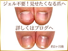 ステラルーテ(Stella lute)