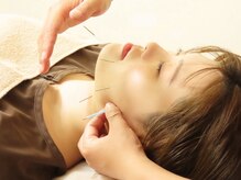 鍼灸院 虹/鍼灸　美容鍼