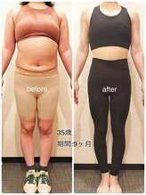 24ダイヤモンドジム 住吉店(24 DIAMOND GYM)/before/after