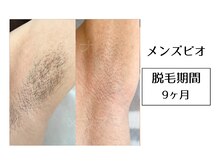 メンズビオ 神戸三宮店/