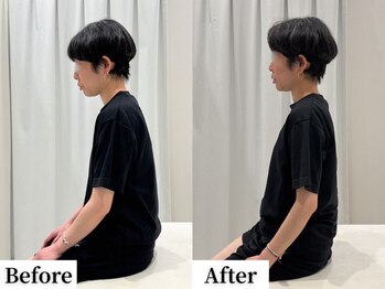 ソレア(Solea)/巻き肩・肩こり改善1回目