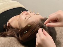 アウル なかもず店(OWL)の雰囲気（【４０代以降の女性に選ばれる!!美容鍼灸】たるみ・しわのWケア）