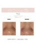 毛穴吸引+光フェイシャル★ニキビ、毛穴ケアに¥18,150