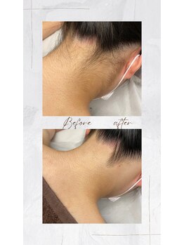 アトレ(Atre)/うなじ美肌変身♪