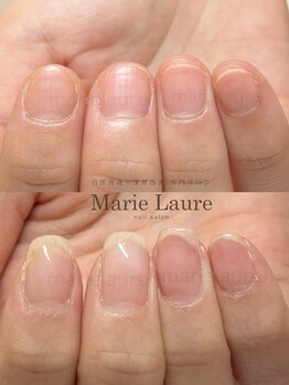 マリーロール 淀屋橋本店(Marie Laure)/自爪育成/深爪矯正/ネイルケア