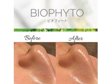 トータルビューティーサロン ルース(LUZ)/ビオフィート