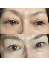 トータルビューティーサロンリア(Li'a)/【40代後半のお客様】