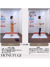 ほねつぎ総社 はりきゅう接骨院/成果/膝の痛み