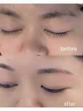 ビュー テンジン 天神 大名(VIEW TENJIN)/アイブロウ・WAX脱毛