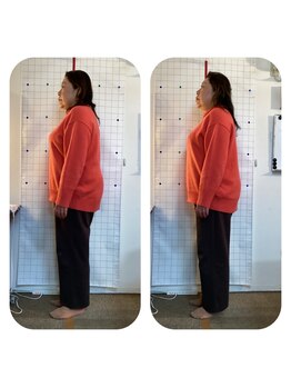 ハンズ治療院 東中野院/「姿勢矯正の症例」