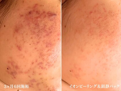 アクール(Accueil)の写真