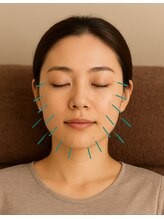 オレンジ接骨院/定額制美容鍼40本コース【8回】