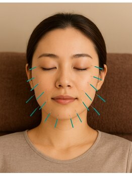 オレンジ接骨院/定額制美容鍼40本コース【8回】