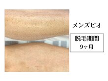 メンズビオ 神戸三宮店/