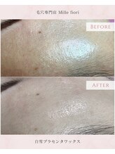 ミルフィオリ(Mille fiori)/白雪プラセンタワックス